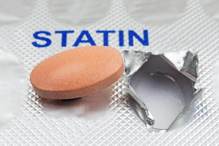 ผู้ป่วยจำนวนมากหยุดกินยากลุ่ม statin เนื่องจากอาการปวดกล้ามเนื้อ แต่ยากลุ่ม statin ไม่ได้ก่อให้เกิดขึ้น
